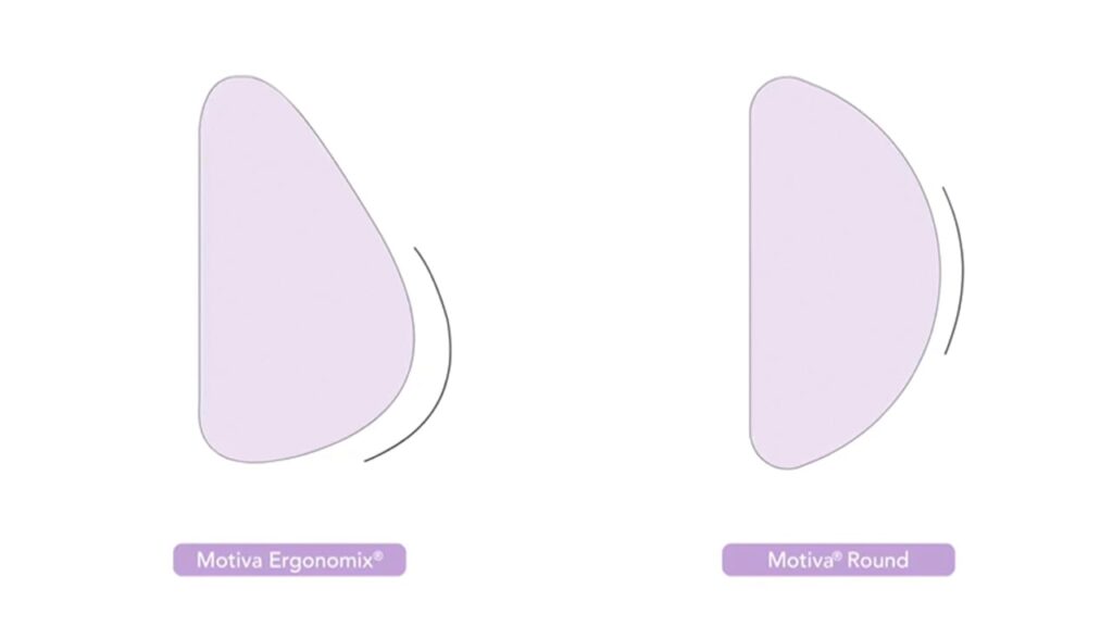 breast implant shape