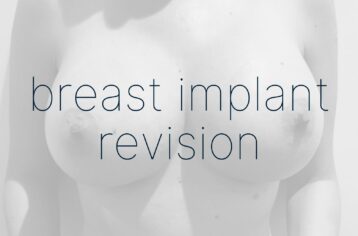 breast revision before and after