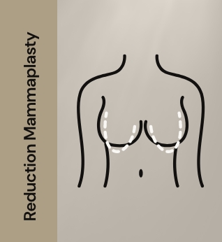 Breast reduction mammaplasty 11