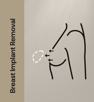 Breast implant removal 11
